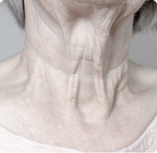 Turkey Neck